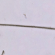 Imagen para el artículo titulado Folículos cultivados en un laboratorio japonés abren una nueva esperanza contra la calvicie